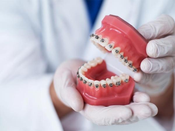 چه کسانی احتیاج به ارتودنسی دندان دارند؟